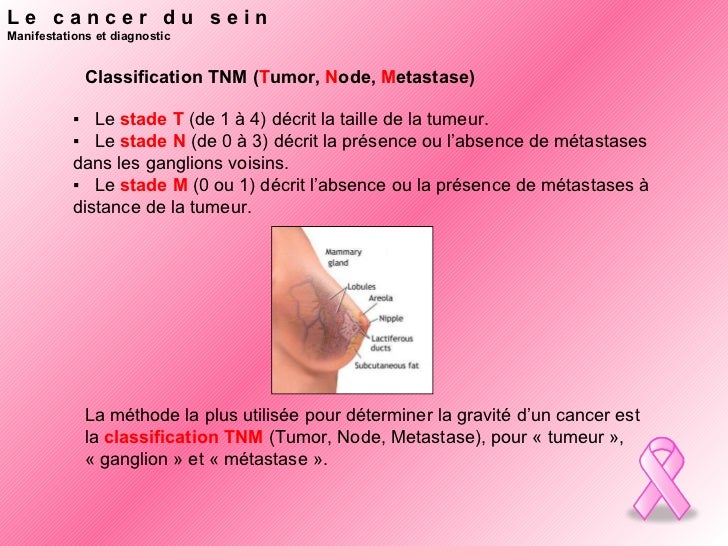 debut du cancer du sein debut du cancer du sein